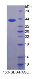 SDS-PAGE (SLC2A4-1644H).jpg